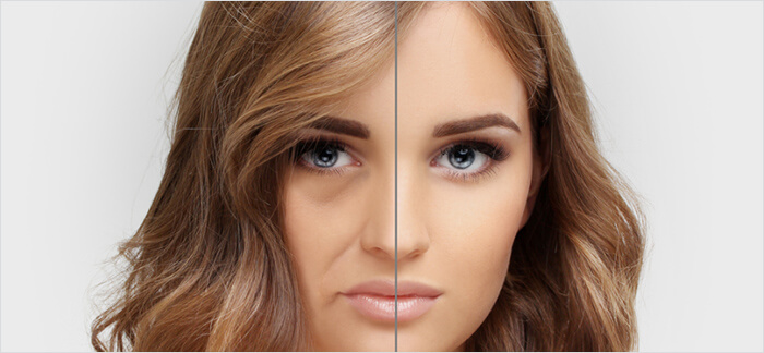 Discover Your New Beauty: Facial Fat Injection Aesthetics